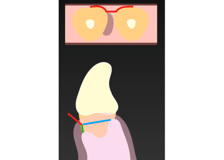 治療中
